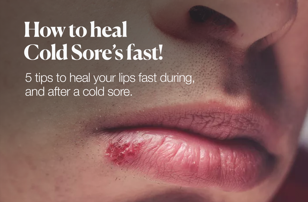 How to help heal Cold Sores fast!