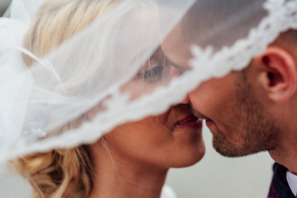 How to stay cold sore free on your wedding day.